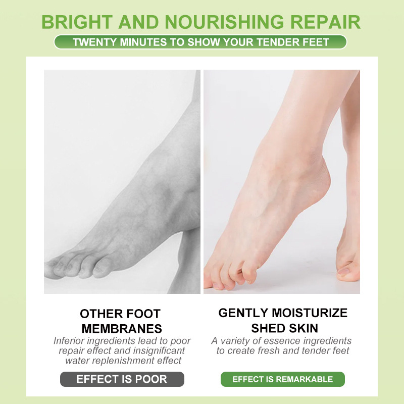 Disposable Avocado Vitamin E Nourish Foot Peel Fool Mask